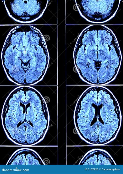 the villages brain ct scan|The Villages .
